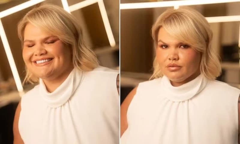 Thais Carla choca a web ao revelar peso atual após bariátrica;